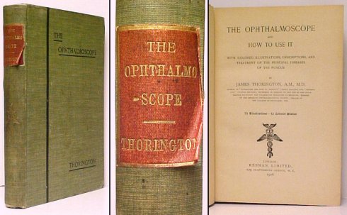 Opthalmoscope and How To Use It Image for Opthalmoscope and How To Use It
